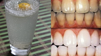 'Nước thần' giúp răng vàng ố lâu năm trắng bóng bất ngờ