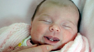 Bác sĩ mổ đẻ 'ngã ngửa' vì bé vừa chào đời đã mọc răng