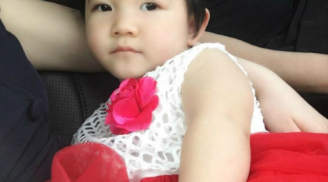 Bất ngờ với hình ảnh bé gái SaPa 14 tháng tuổi nặng 3,5kg 'lột xác' xinh như công chúa