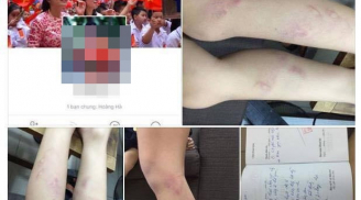 Hà Nội: Vào cuộc điều tra vụ 11 học sinh lớp 2 bị giáo viên bạo hành gây bức xúc