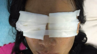 Điểm tin mới ngày 3/1: Quảng Bình, con dâu bị mẹ chồng tạt thẳng ca axit vào mặt