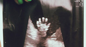 Thai nhi 20 tuần tuổi giơ bàn tay năm ngón tạo dáng như đang vẫy chào trong bụng mẹ