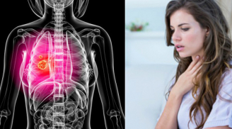 Những dấu hiệu cảnh báo ung thư phổi ở phụ nữ