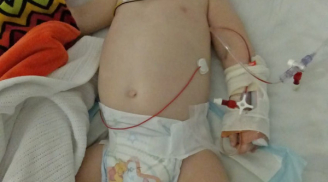 Bé trai 10 tháng tuổi bất ngờ viêm màng não sau khi ngồi xe đẩy siêu thị