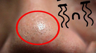 Chạy ngay xuống bếp lấy muối và kem đánh răng trộn với nhau như thế này nhé