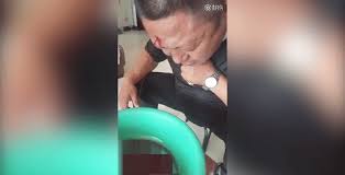 Video: Bệnh nhân chảy máu ồ ạt sau khi bác sỹ châm cứu