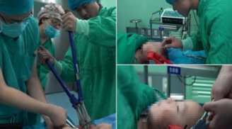 Xót thương: Bé trai bị ô tô đồ chơi găm vào đầu