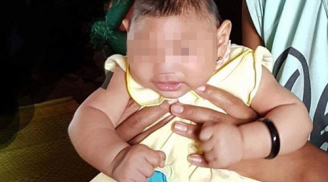 Cảnh báo: Em bé Việt Nam đầu tiên nghi bị mắc chứng đầu nhỏ do virus Zika