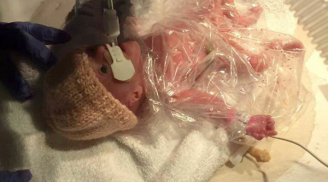 Điểm tin 30/10: Xúc động Em bé chào đời trong bọc ối sống sót kỳ diệu nhờ... chiếc túi nilon