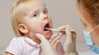 Mách mẹ mẹo xử trí khi trẻ bị sốt đau do mọc răng