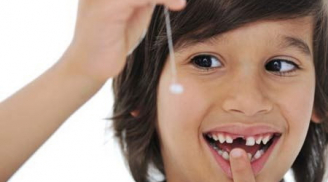 Cách nhổ răng sữa cho trẻ đúng thời điểm