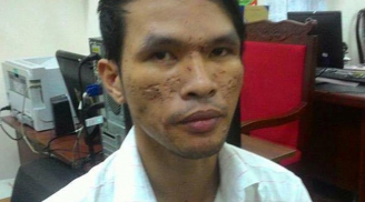 Vụ bé trai bị hành hạ dã man: Bắt nghi can ngay tại Sài Gòn