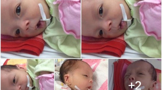 Người mẹ trẻ khóc cạn nước mắt khi phát hiện con trai 1 tháng tuổi bị đa dị tật