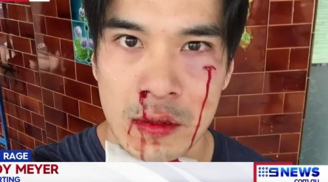Diễn viên Thiên Nguyễn bị đánh trên đường phố Australia