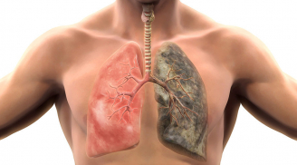 Người hút thuốc lá lâu năm chỉ cần uống hỗn hợp nước này vào cũng thanh lọc phổi ngay lại ngừa ung thư