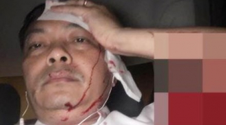 NÓNG: Giám đốc nhân sự cà phê Trung Nguyên bị đánh chảy máu đầu, gãy nhiều ngón tay