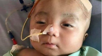 Bé trai bị não úng thủy: Thông tin MỚI NHẤT về bé Đức Lộc sau khi về Việt Nam