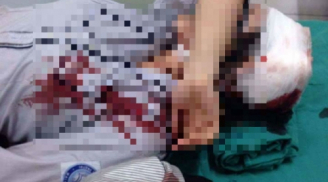 Hà Nội: Nữ sinh cấp 3 nhập viện do bị bạn đánh vào đầu