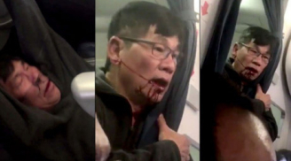 Bác sỹ gốc Việt bị lôi xềnh xệch, đuổi khỏi máy bay của United Airlines khiến cả thế giới phẫn nộ