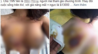 Thanh tra Sở Y Tế Hà Nội xử lý vụ cô gái phẫu thuật nâng ngực gần 300 triệu phải nhập viện cấp cứu