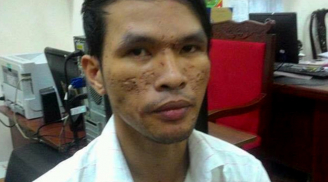 Kẻ hành hạ, chích điện bé trai Campuchia bị truy tố đến 3 năm tù