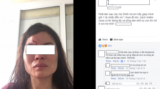 Phẫn nộ hình ảnh người phụ nữ bị chồng đánh chảy máu mũi
