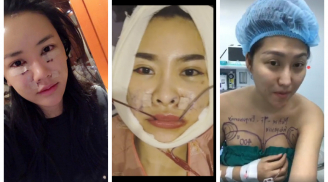 Phát hoảng với gương mặt kì dị của mỹ nhân Việt khi mới 'đập mặt xây lại'