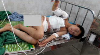 Hoàn cảnh đáng thương của bé trai 10 tuổi bị bỏng nặng vì điện giật