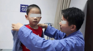 Vụ 80 bé trai bị sùi mào gà sau khi cắt bao quy đầu: Khó chữa vì trẻ chưa biết hợp tác điều trị