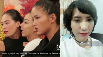 Thí sinh Vietnam Next Top Model 2017 tiết lộ bất ngờ về việc bị đánh gãy mũi