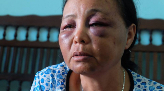 Toàn cảnh vụ việc 2 người phụ nữ bán tăm bị người dân Sóc Sơn đánh trọng thương do nghi bắt cóc trẻ em
