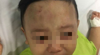 Vụ bé trai 1 tuổi bị bạo hành nghiêm trọng: Công an 'giăng lưới' 5 đối tượng tại bệnh viện