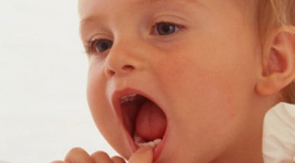 Trẻ mấy tháng tuổi thì mọc răng hàm?