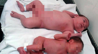 Bé gái chào đời với cân nặng 5,7 kg khiến mẹ và các nhân viên y tế kinh ngạc