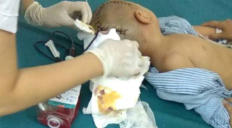 Thái Bình: Bé trai 3 tuổi bị xuất huyết não khi đi học ở trường mầm non