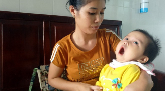 Xót thương bé gái 13 tháng tuổi teo não, mất nhận thức, tay chân co quắp chỉ vì một vết côn trùng cắn
