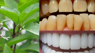 Chỉ với nắm rau quen thuộc, cao răng lâu năm đến mấy cũng phải bật ra từng mảng