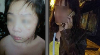 Mẹ đẻ bé trai 10 tuổi nghi bị bố và mẹ kế đánh gãy xương sườn, rạn sọ não: 'Khi gặp tôi không nhận ra con'
