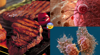 11 loại thực phẩm gây ung thư cao kinh hoàng