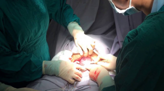 Sinh mổ lần 3 cách lần 2 bao lâu?