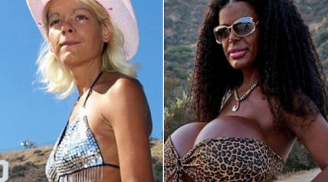 Phát hoảng người mẫu ngực khủng nhất Châu Âu tiêm thuốc nhuộm để thành da đen
