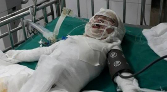 Buồn: Bé gái 3 tuổi ngã vào hố vôi đang sôi sùng sục ở Nghệ An đã qua đời