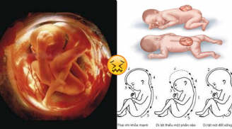 4 loại cá mẹ bầu càng ăn nhiều thai nhi càng chậm phát triển, bị dị tật