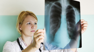 Hướng dẫn cách chăm sóc cho người bị bệnh bụi phổi atbet (amiăng)
