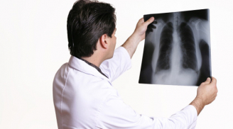 Hướng dẫn cách chăm sóc cho người bị bệnh bụi phổi silic