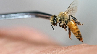 Sử dụng nọc ong trị bệnh, một người phụ nữ t.ử v.ong