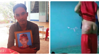 Bé 8 tuổi bị thiệt mạng ở Bình Phước từng bị bạo hành từ nhiều ngày trước đó