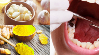 7 nguyên liệu có sẵn trong nhà trị đau răng hiệu quả nhất