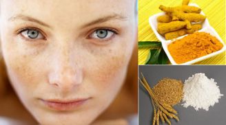 Những cách trị nám tận gốc từ thiên nhiên hiệu quả sau 5 ngày