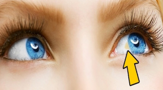 Nhận biết các bệnh nguy hiểm qua những dấu hiệu bất thường ở đôi mắt